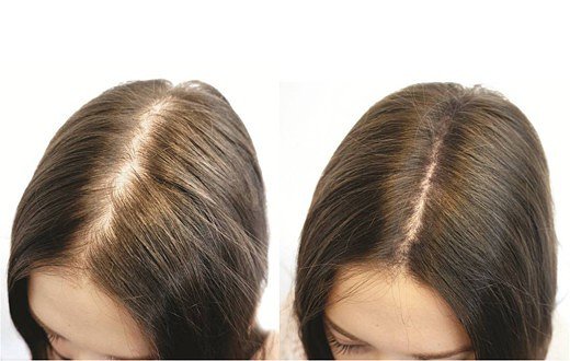 Сыворотка против выпадения волос - Occuba Active Serum (Новая формула 2022 года)